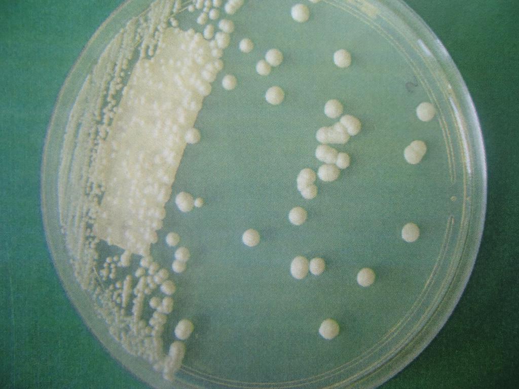 Infecções Fúngicas